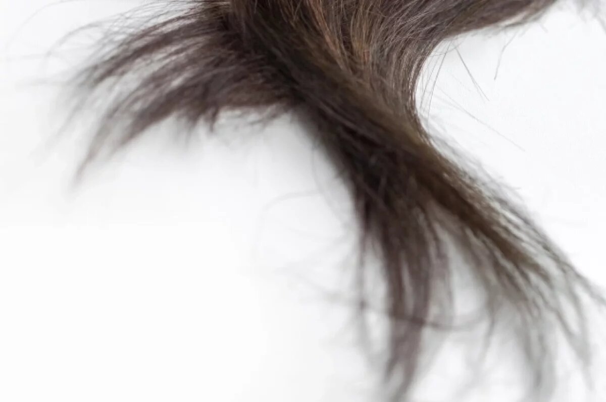    В кишечнике подростка из Ижевска врачи нашли более 2 кг волос и ниток