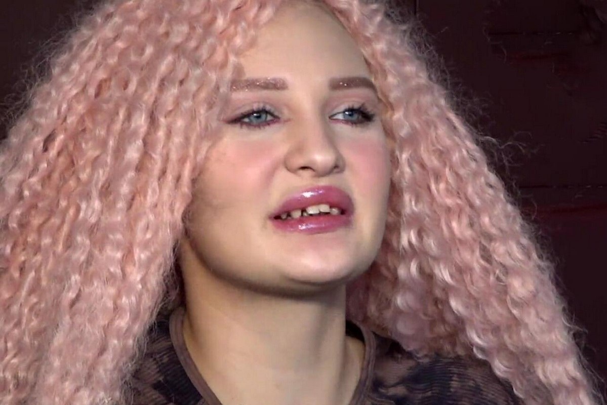    Мелисса Фокс до. Фото: соцсети