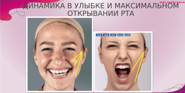 рис. 1. Динамические вектора. 