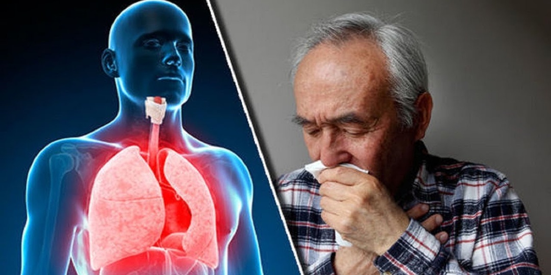 Хроническая обструктивная болезнь лёгких: всё, что нужно знать