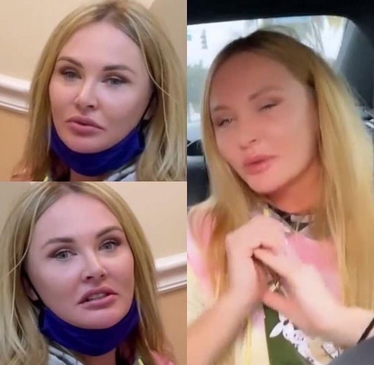 Ссылку на статью о филлерах оставлю ниже 