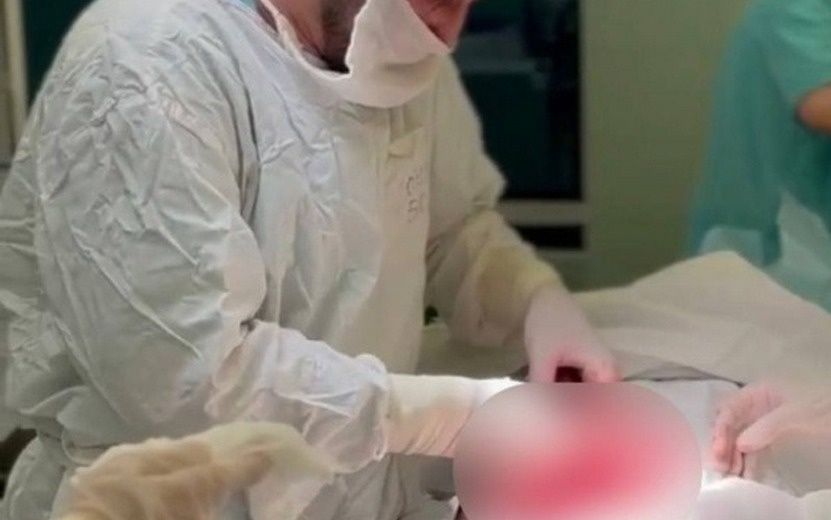    2 кг волос извлекли из кишечника подростка врачи в Ижевске