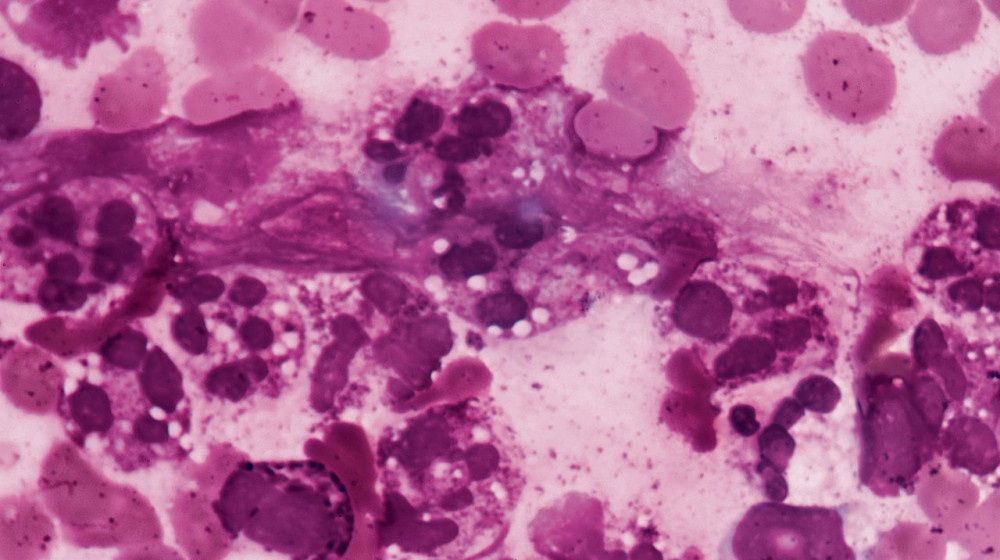    Татуировка или опасность: как дети становятся подпольными мастерами