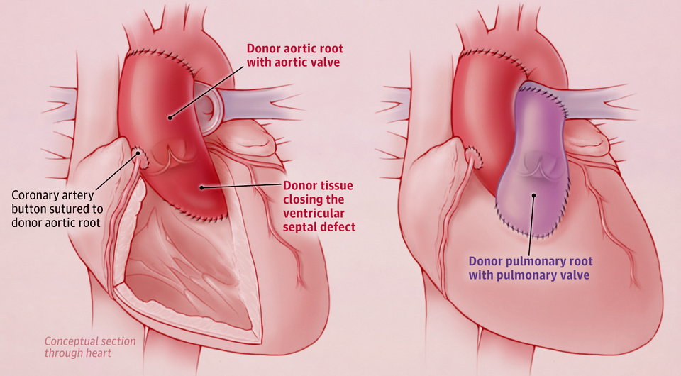   Joseph W. Turek et al. / JAMA, 2024