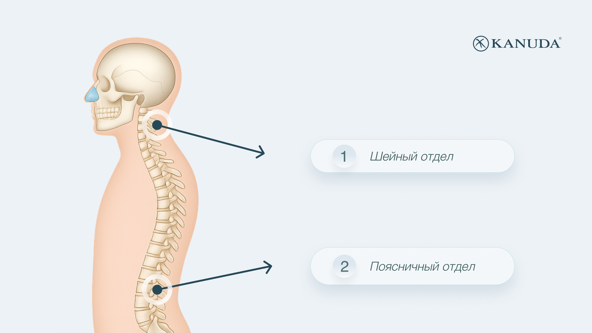 1 - шейный отдел, 2 - поясничный отдел 