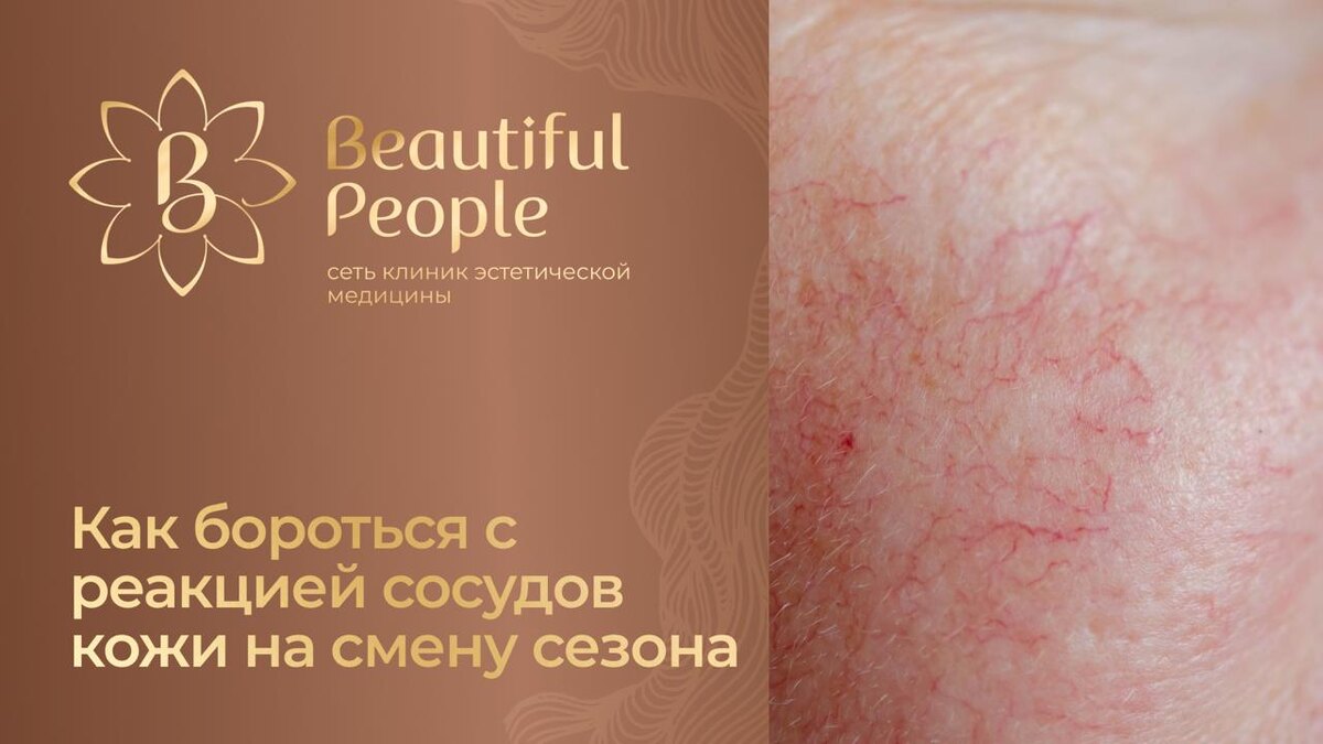 Реакция сосудов кожи на смену сезона