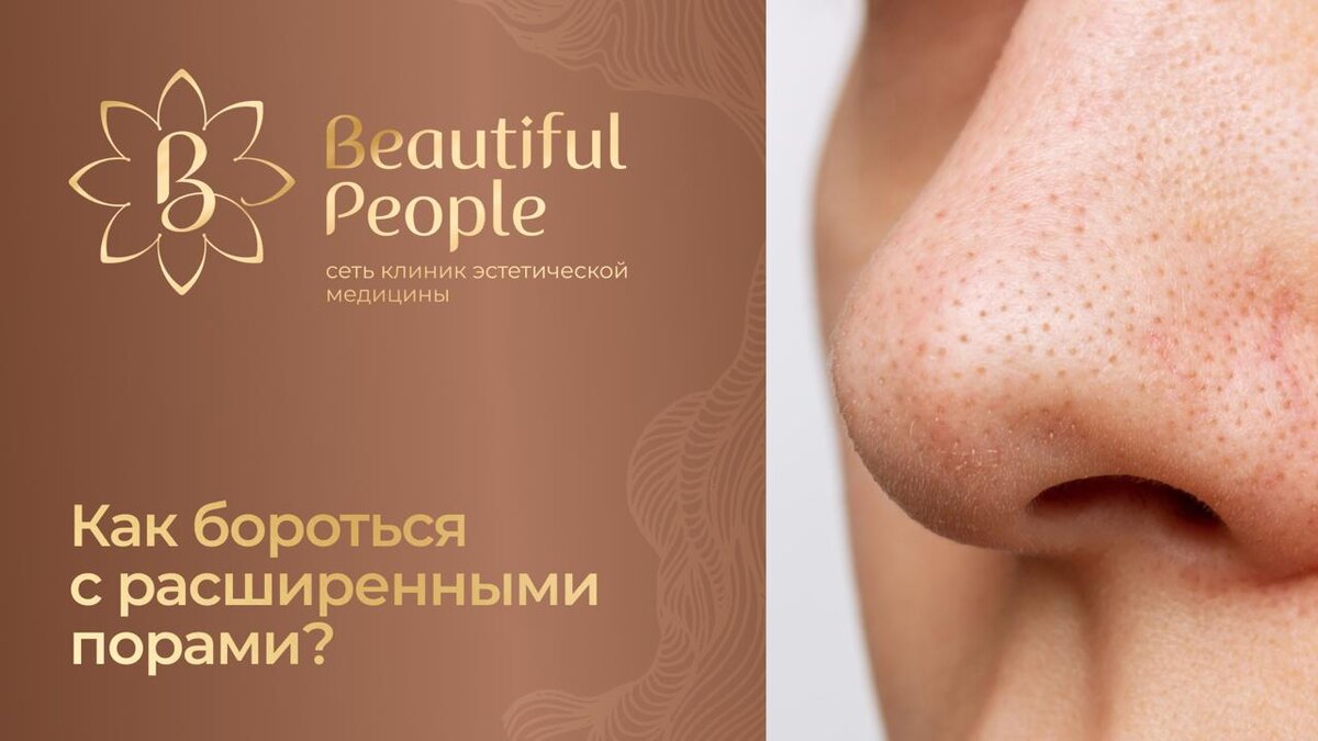 Как избавиться от расширенных пор