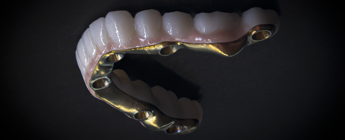 Готовая циркон-титановая конструкция перед фиксацией.