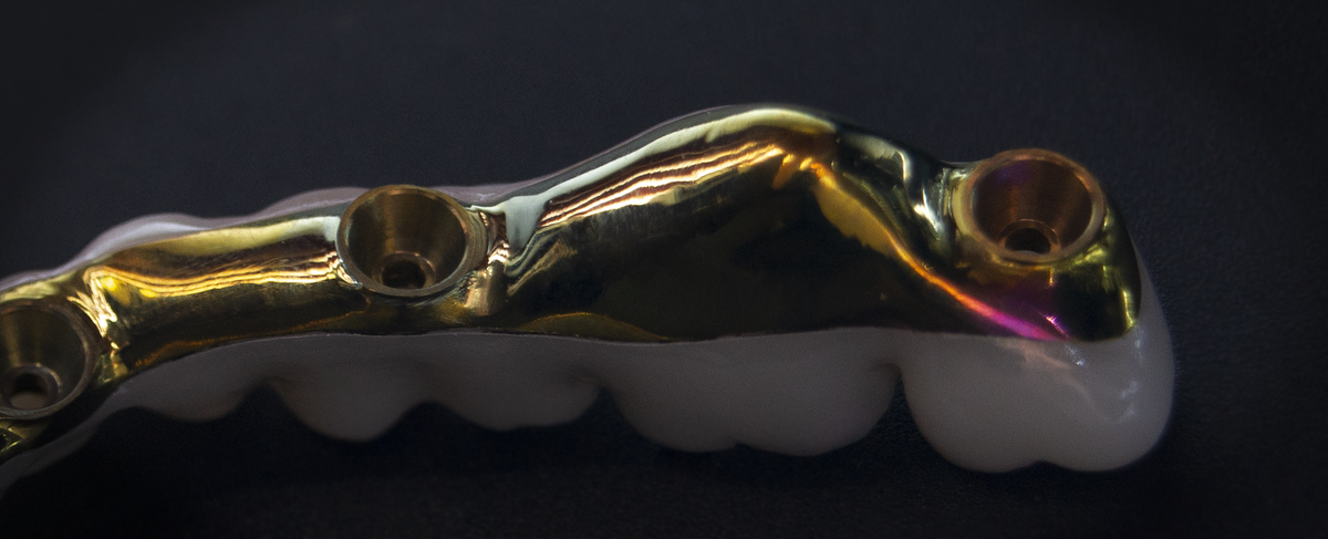 Готовая циркон-титановая конструкция перед фиксацией.