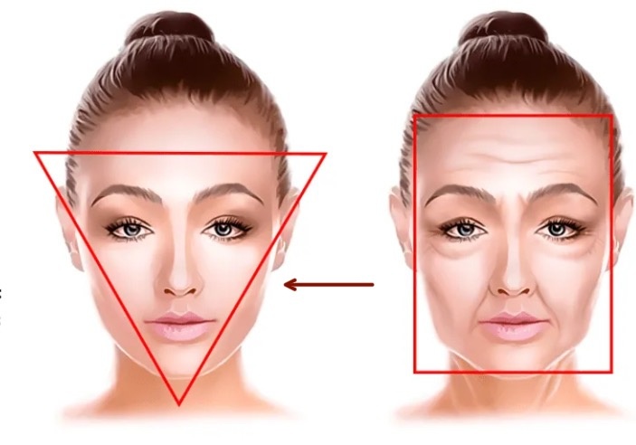 Молодеет и подтягивается на глазах: 5 точек, которые возвращают молодость лицу
