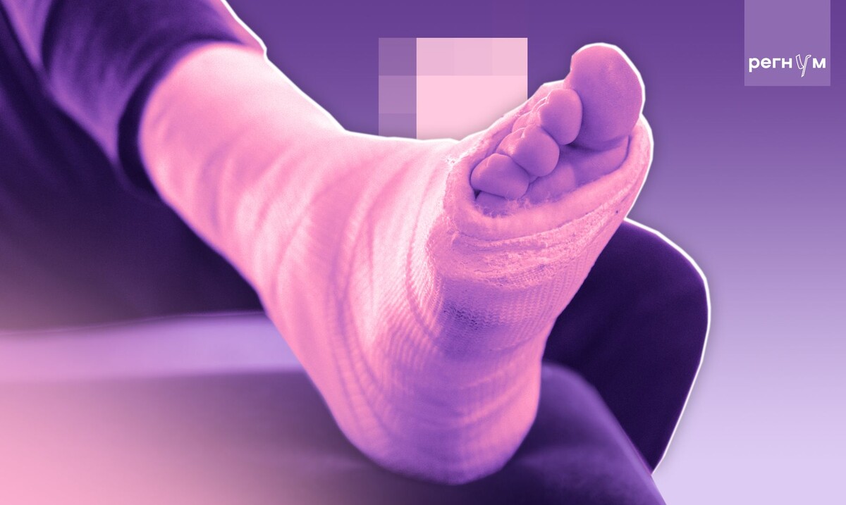    Перелом / Источник: © ИА Регнум