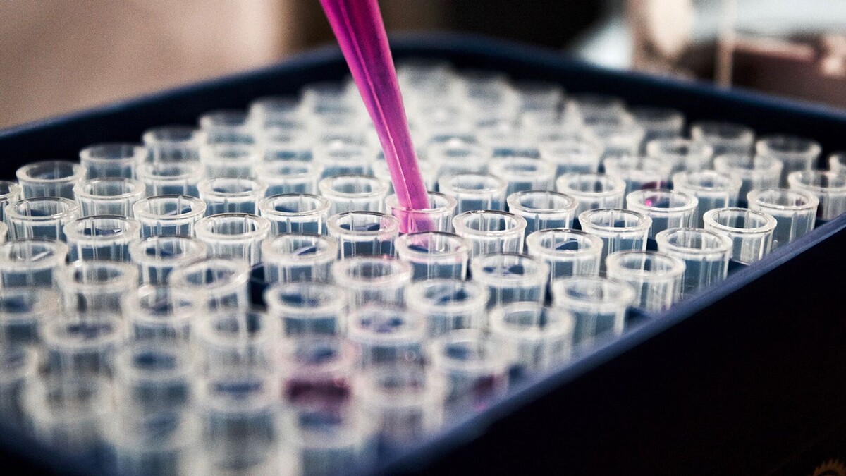 © Photo : Unsplash / Louis Reed