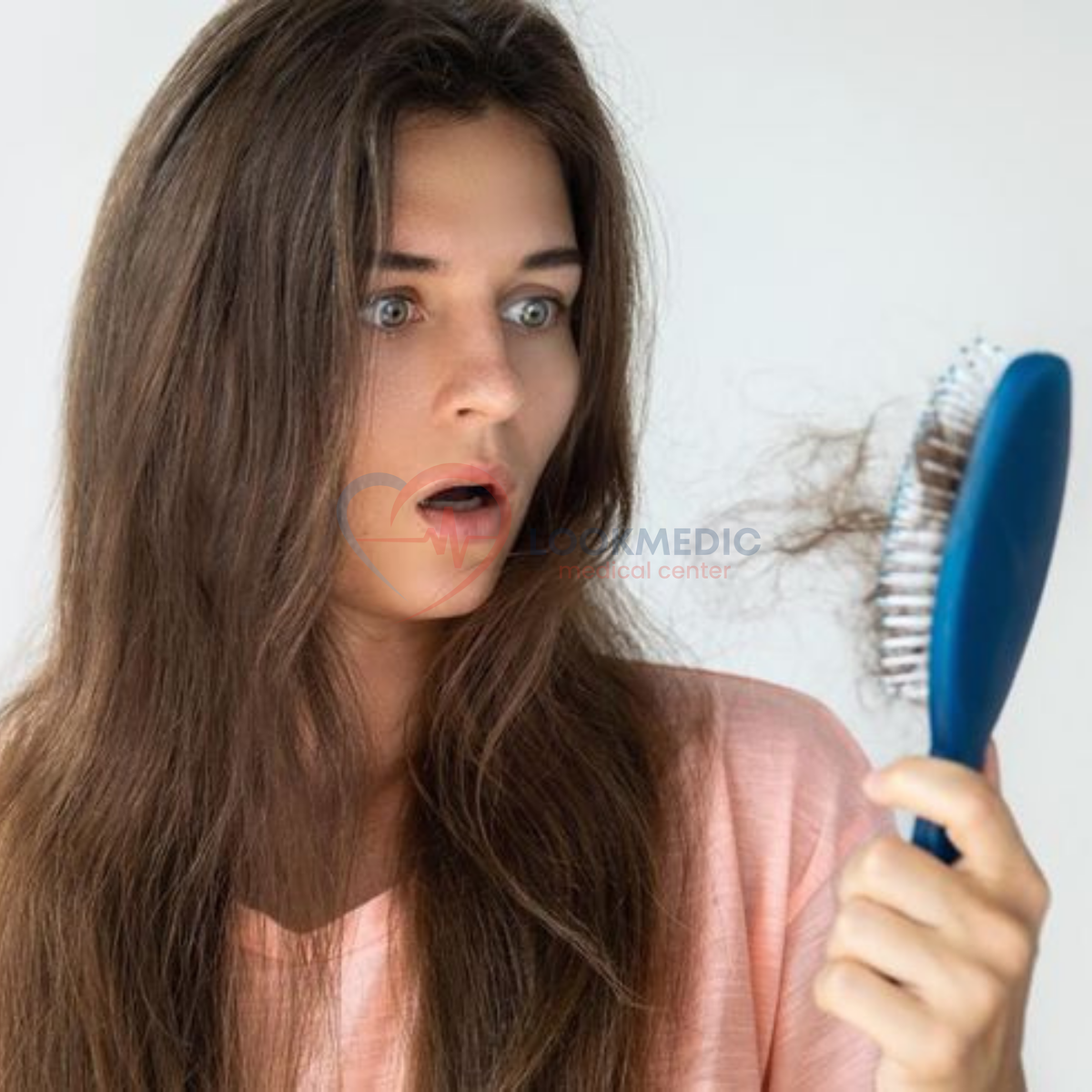 Алопеция у женщин