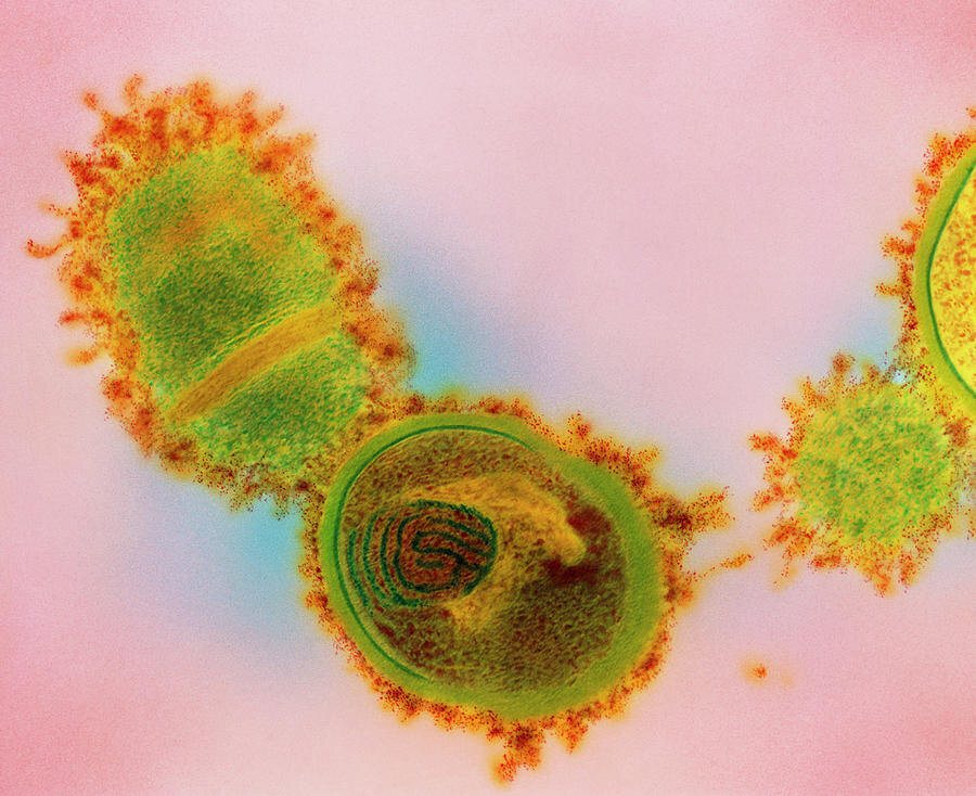 цветная микрофотография, выполненная с помощью сканирующей электронной микроскопии (SEM). Показывает характерные цепочки кокков, окружённые капсульным материалом, что визуально подчёркивает их грамположительную природу и мицеллярную структуру.
Источник sciencephotogallery.com