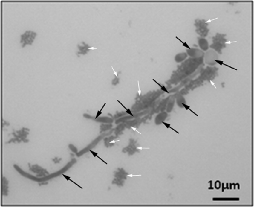 Взаимодействие с Candida albicans: Микрофотография, где S. salivarius окружает клетки грибка, демонстрируя потенциал к подавлению колонизации. 
