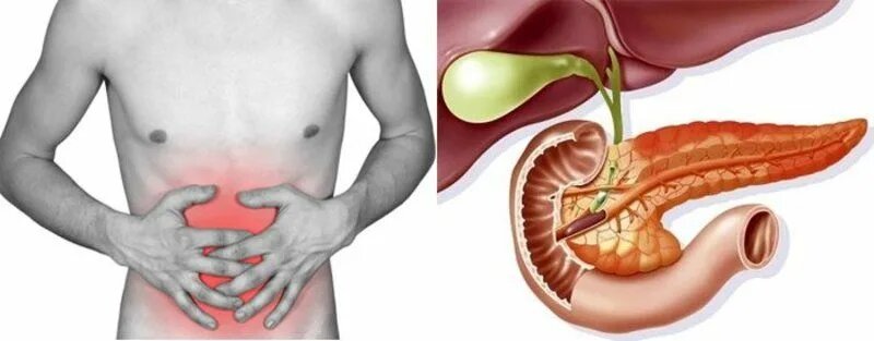 Панкреатит: что это, как распознать и как выжить после приступа