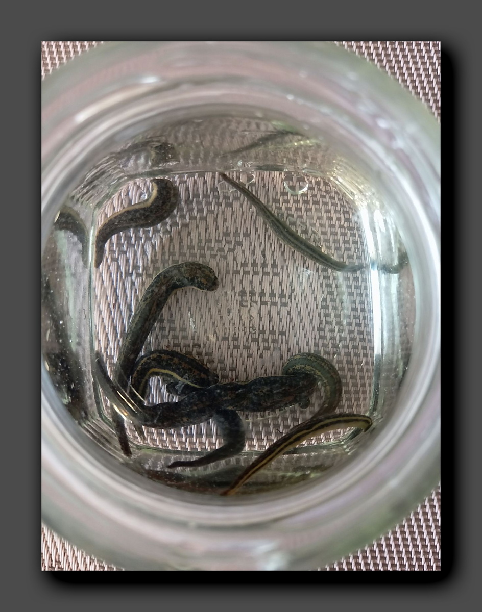 «Помощники» моей подруги. К слову, это одноразовый «инструмент» лечения