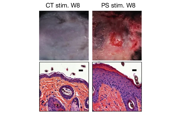   Serhan et al. / Nature, 2025