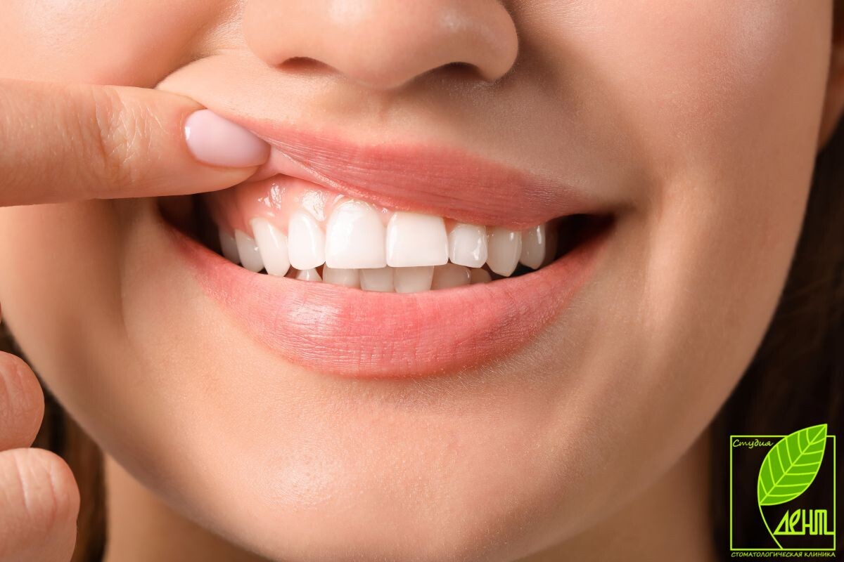 Отбеливание зубов уже несколько 
десятилетий остаётся одной из самых востребованных неинвазивных процедур
 для улучшения эстетики улыбки. Рост популярности видеоконференций в 
период пандемии COVID-19 сделал внешний вид зубов ещё более заметным, 
что усилило интерес к эстетической стоматологии.



