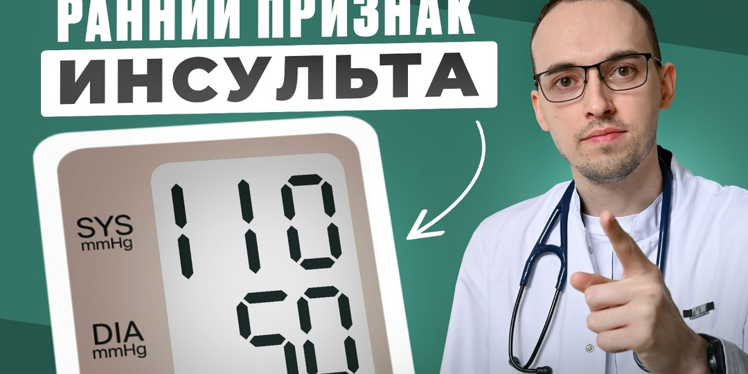 10 ранних признаков инсульта: как распознать и вовремя среагировать