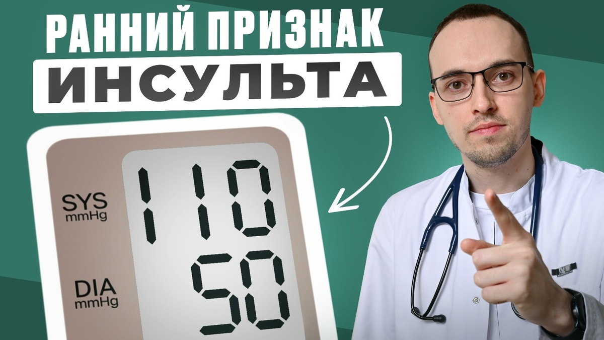 10 ранних признаков инсульта: как распознать и вовремя среагировать