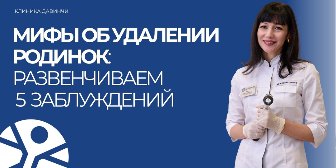 Мифы об удалении родинок: развенчиваем 5 заблуждений