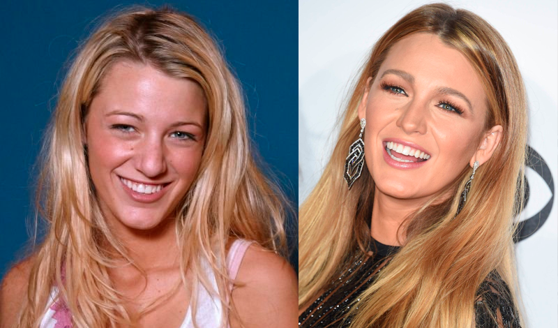 Блейк Лавли