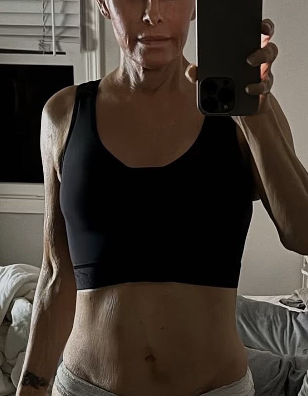    Николь Эггерт после операцииСоцсети Николь Эггерт