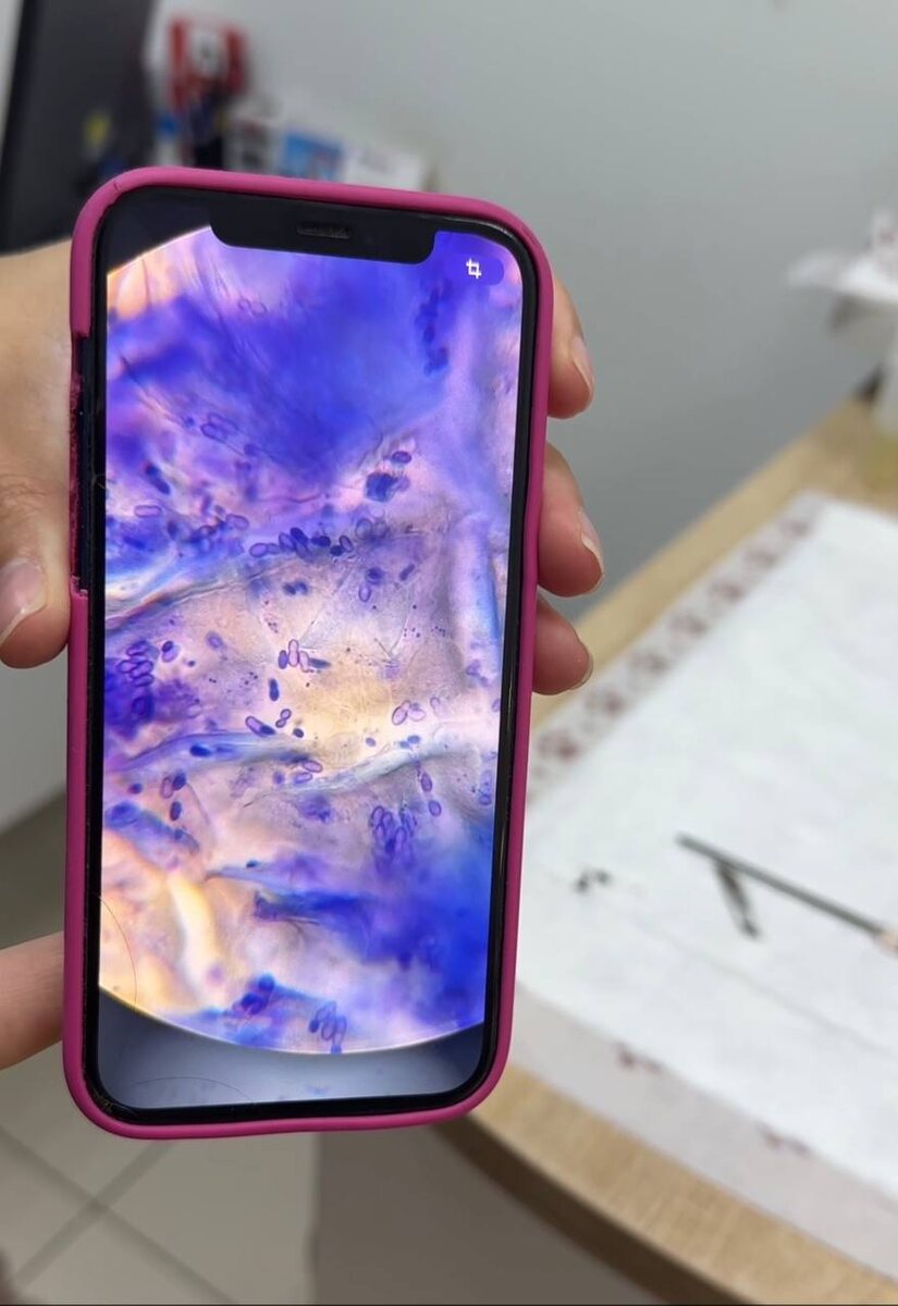 Так выглядели ее шерстинки под микроскопом. Фото из архива автора