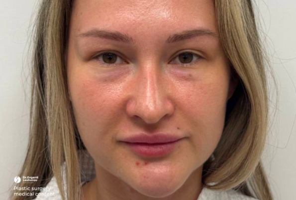 До операции