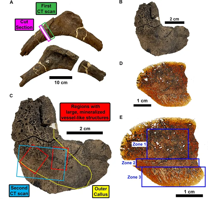 Фотографии сломанного ребра из RSKM P2523.8.

(A) Противоположные виды головки ребра, показывающие участки с костной мозолью, выбранные для КТ-сканирования (зелёный квадрат) и распила (пурпурный квадрат).

(B) Поперечное сечение спиленного костного блока.

(C) Подписанный блок из (B), указывающий рост кости, вызванный переломом (жёлтая линия), область КТ-сканирования (синий квадрат) и сосудоподобные структуры (красные квадраты).

(D) Тонкий срез из блока (B).

(E) Подписанный тонкий срез, выделяющий различные петрографические зоны роста кости. — Mitchell et al., 2025