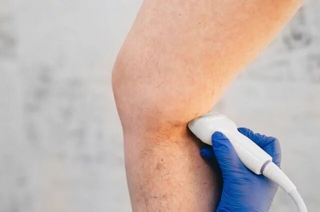    В каком возрасте людям начинает грозить тромбоз?