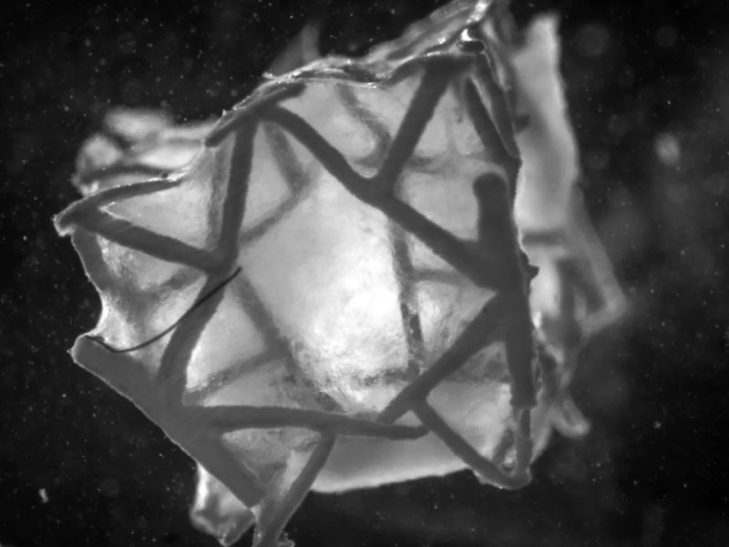    3D-пластырь для сердца закрывает отверстия и восстанавливает ткань [ВИДЕО]