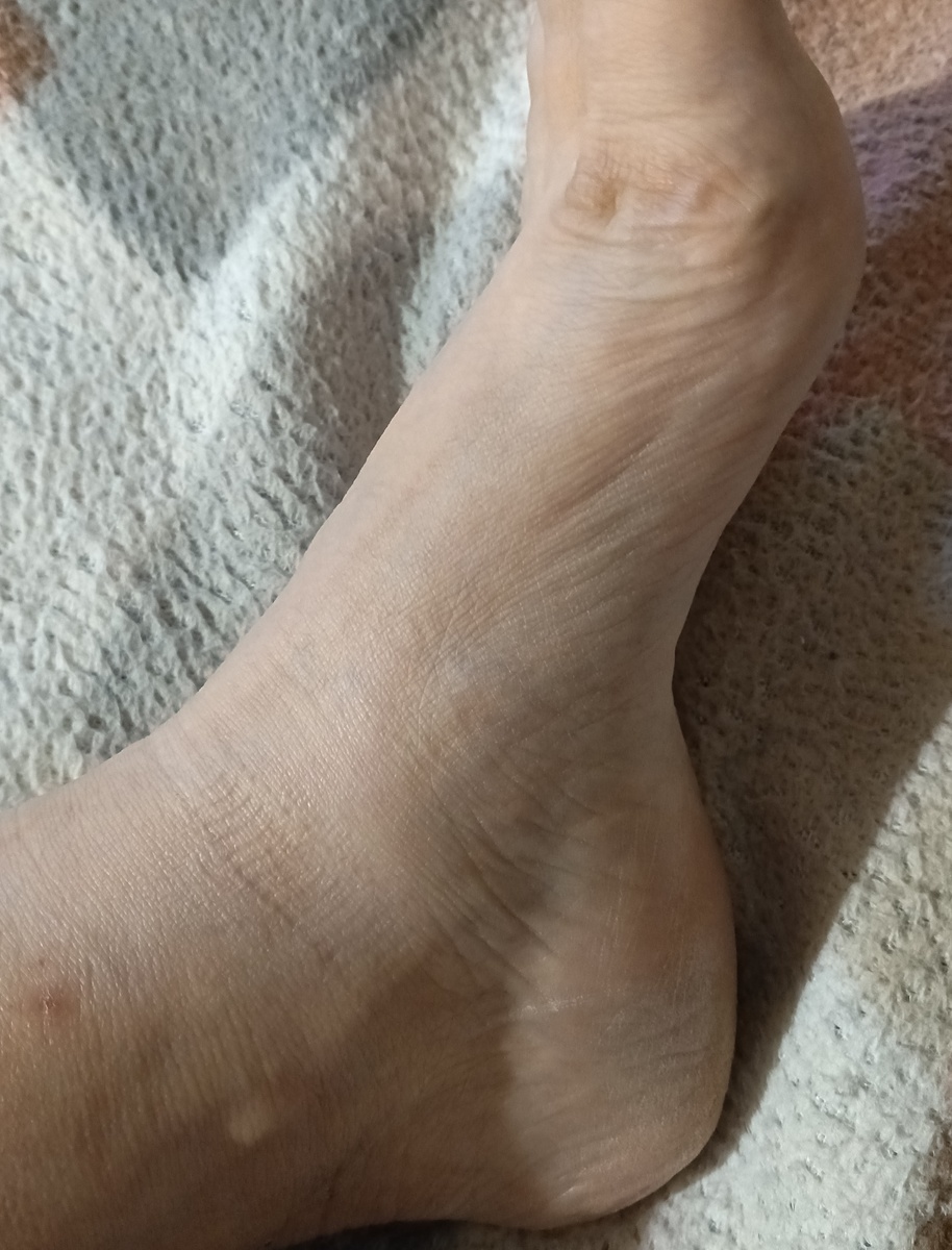 фото автора: виден высокий свод на ноге, в этом месте нога не касается пола