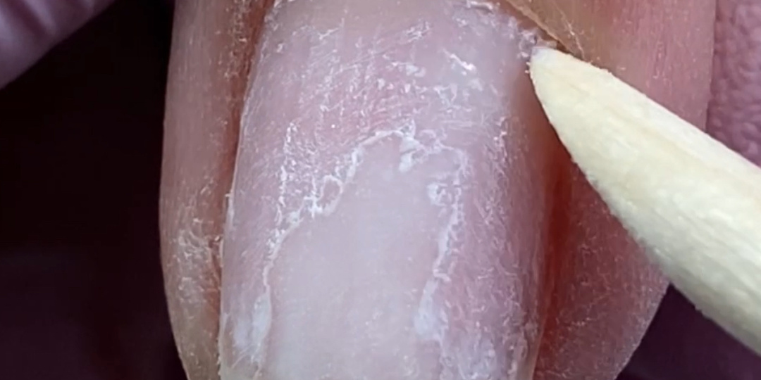 Снятие гель-лак при помощи нитки: за и против