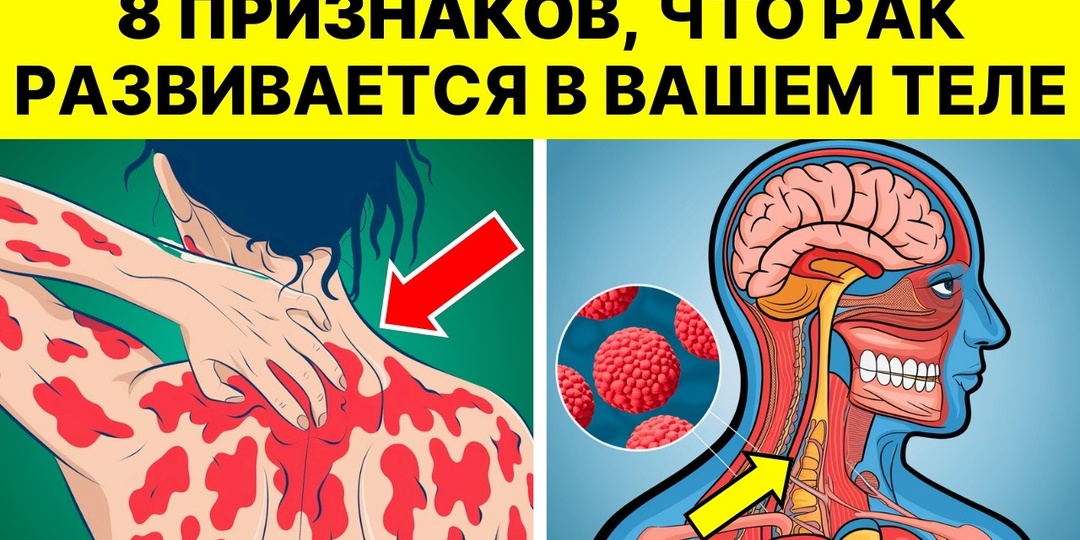 Врачи скрывали: первые признаки рака, которые легко пропустить