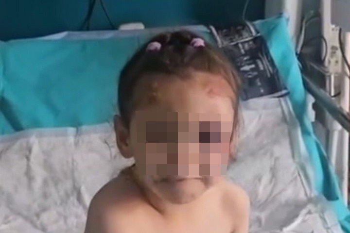 Девочка попала в больницу