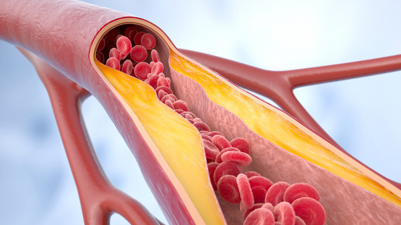 Четыре «страшных» мифа о статинах, с верой в которые пора попрощаться – разбираем с врачом