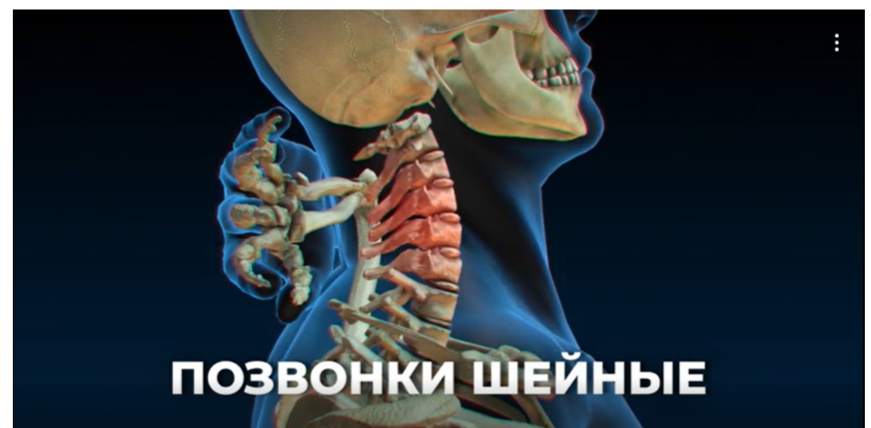 проблемы с шейными позвонками