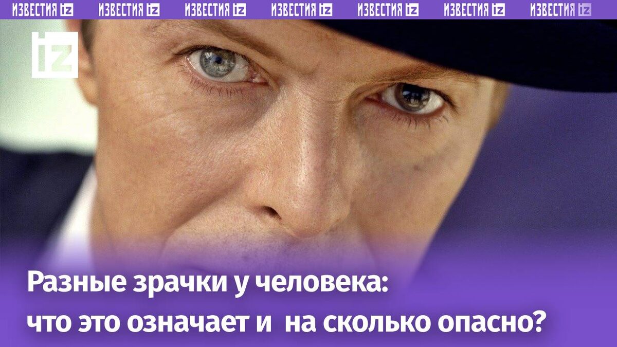 На фото: Дэвид Боуи