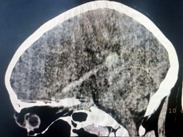    Фото: министерство здравоохранения Кировской области/