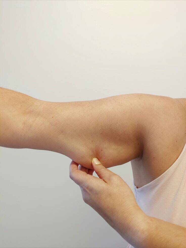 Обвисание кожи у женщин