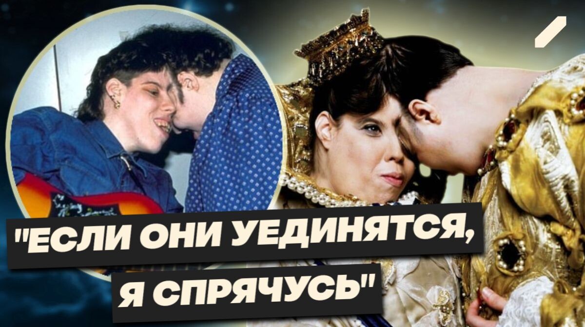 62 года в одном теле: сиамские близнецы из США, которые научились жить счастливо вопреки прогнозам...