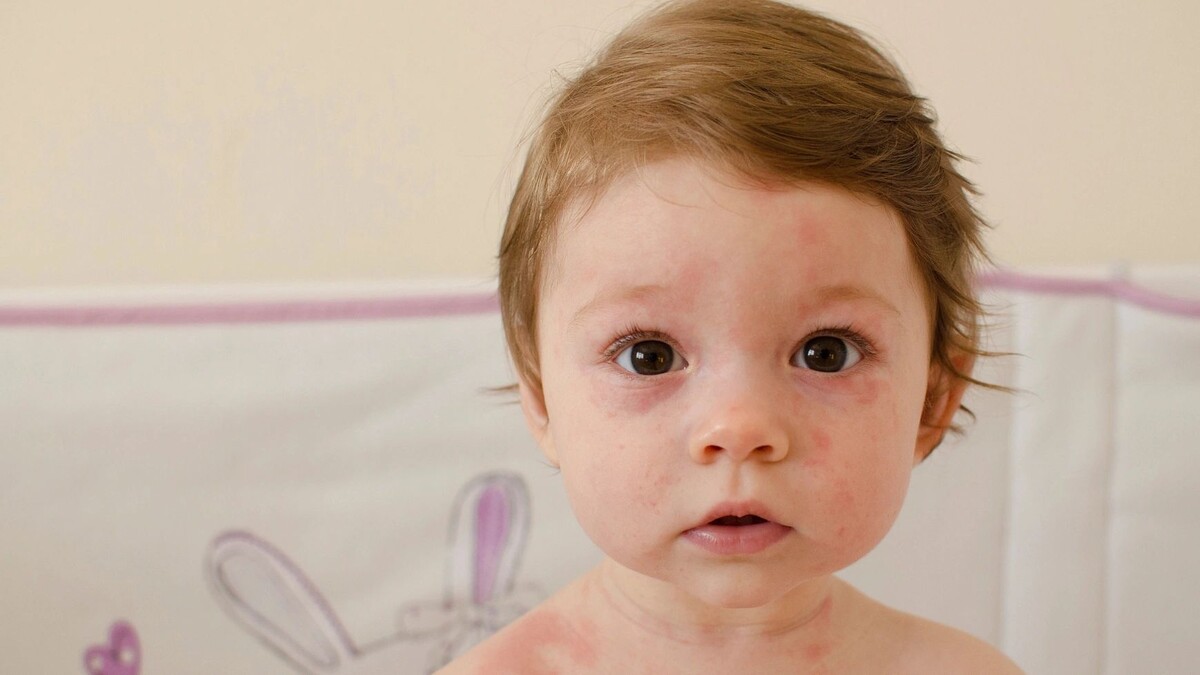    Фото: Little_Desire/Shutterstock/Fotodom