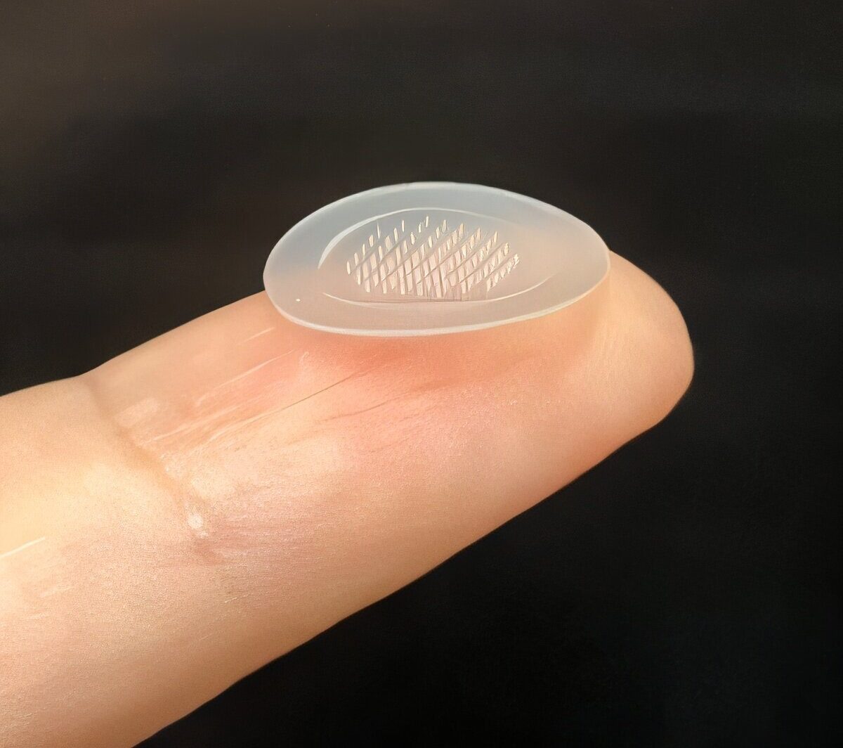    Фото: medicalxpress.com