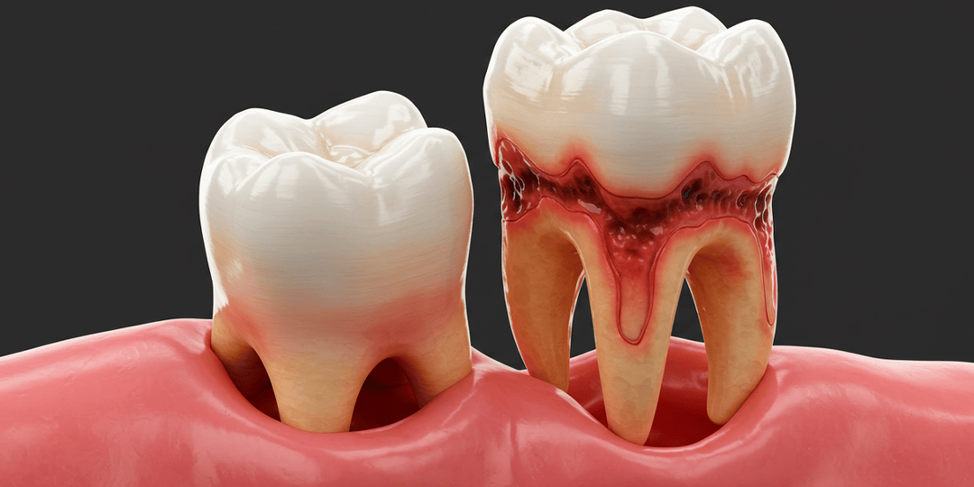 Шатаются зубы у взрослых: причины подвижности и эффективные методы укрепления