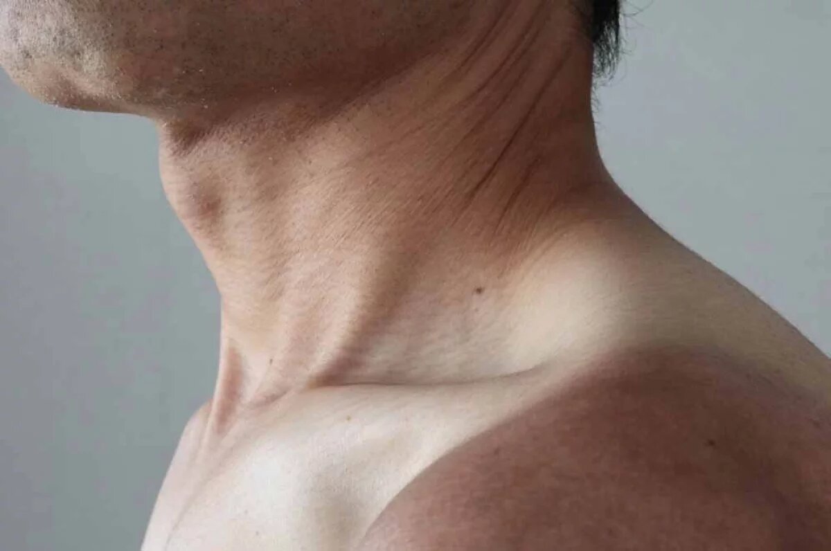    Окружность шеи является самостоятельным и важным показателем здоровья.