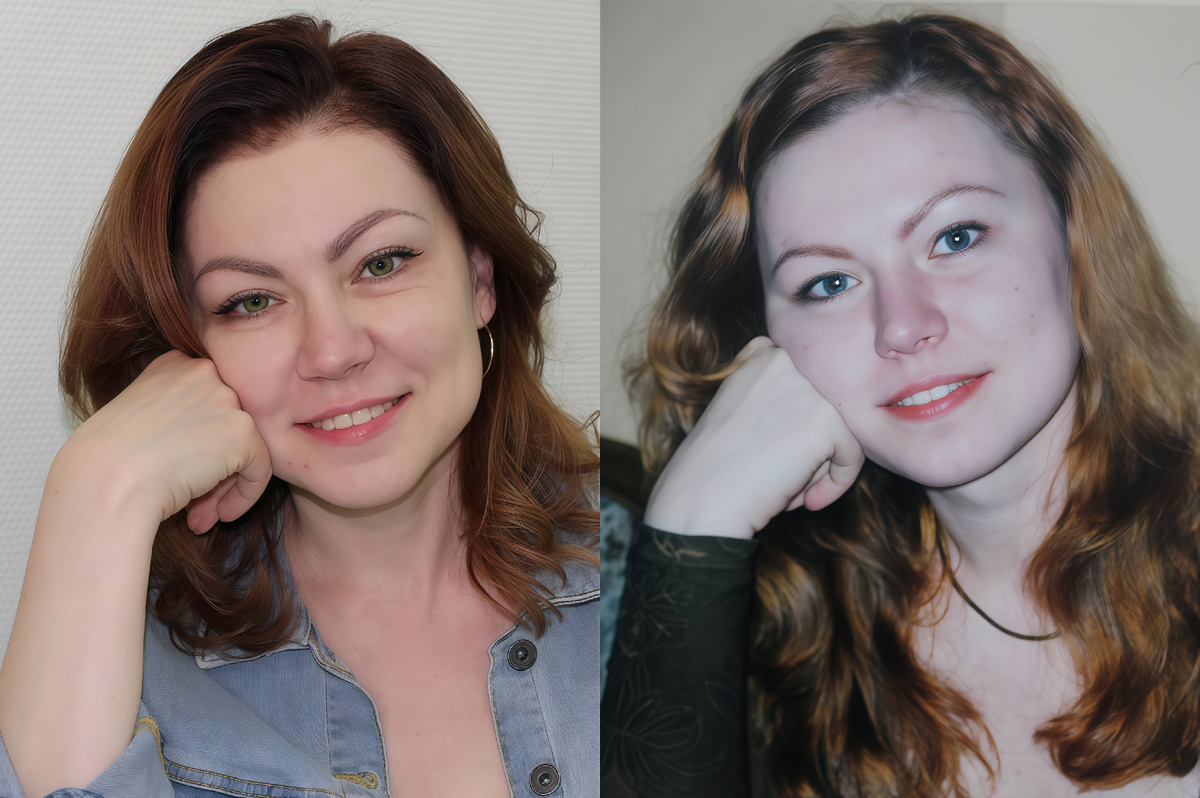 Фото пац ента после работы пластического хирурга и 20 лет назад. 