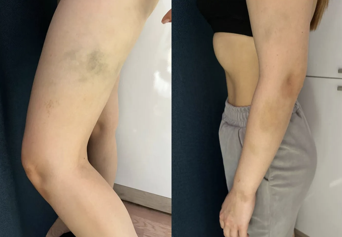     Фотографии пострадавшей