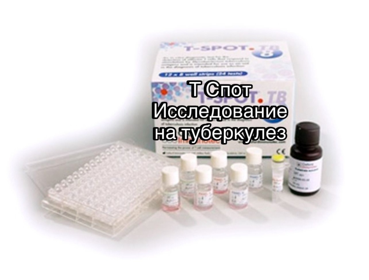 Т спот тест